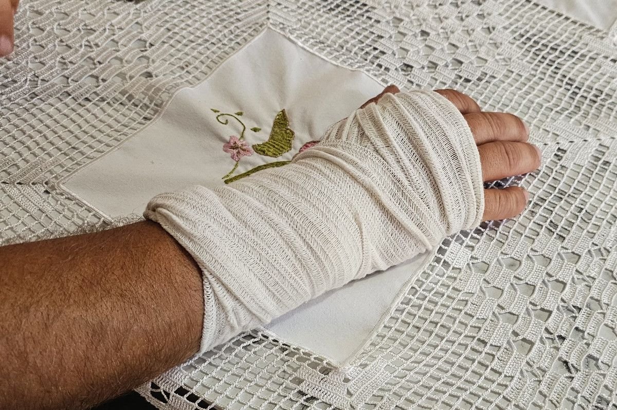 Kastamonu'da sokak köpeğinin saldırısına uğradı: Ayağı iki yerden kırıldı 4