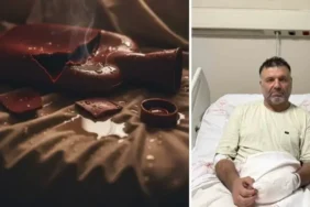 Sıcak torbası patlamasıyla vücudunun yüzde 30’u yandı: '5 dakika geçti, patladı' 6 sicak-torbasi-patlamasiyla-vucudunun-yuzde-30u-yandi-5-dakika-gecti-patladi-l9labyea.webp